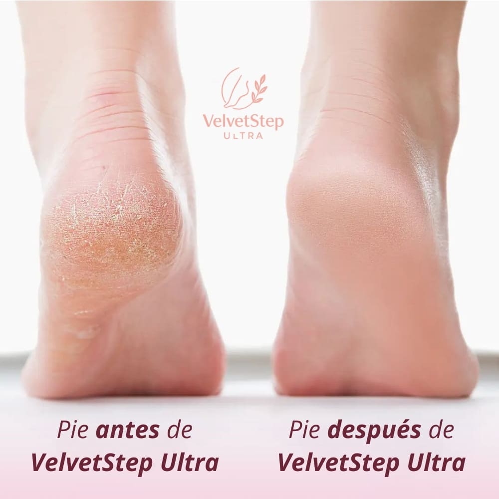 VelvetStep Ultra™